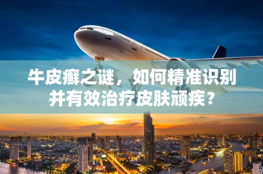 牛皮癣之谜，如何精准识别并有效治疗皮肤顽疾？