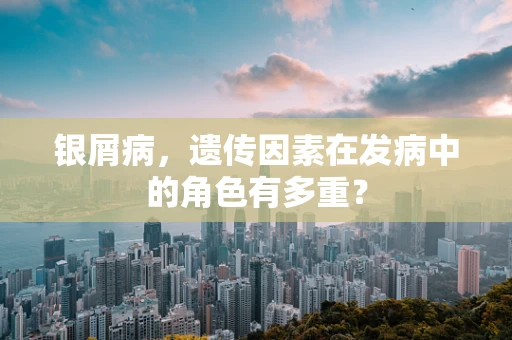 银屑病，遗传因素在发病中的角色有多重？